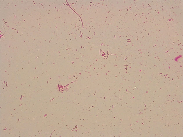 Bacillus Slides - Bacillus 10 1000X